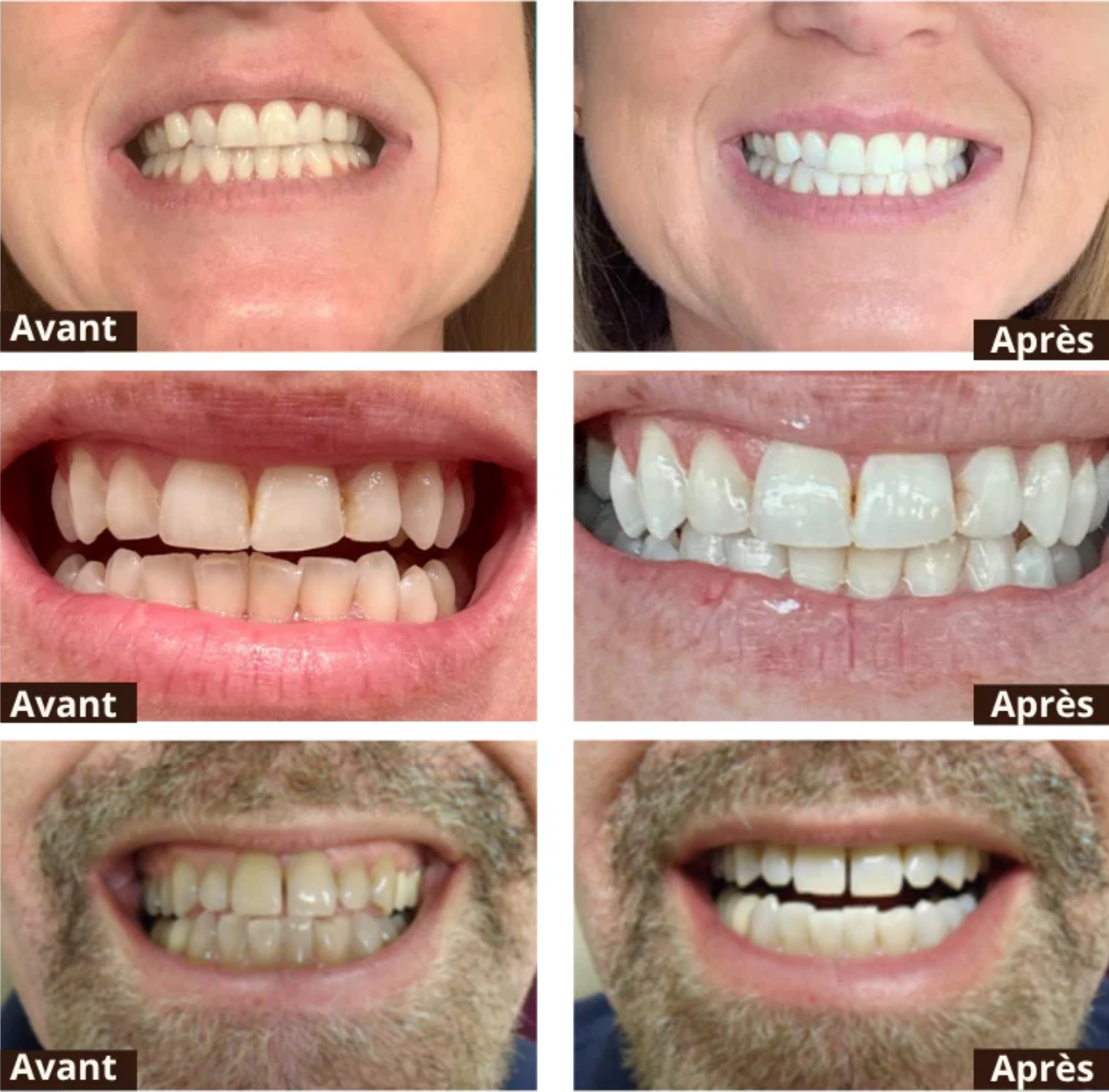 Stylo Blanchissant Express BlancParfait