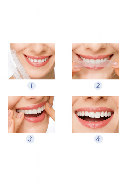 SmileKit 9D White – Bandes Blanchissantes Professionnelles pour les Dents