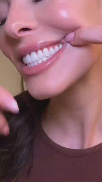 SmileKit 9D White – Bandes Blanchissantes Professionnelles pour les Dents